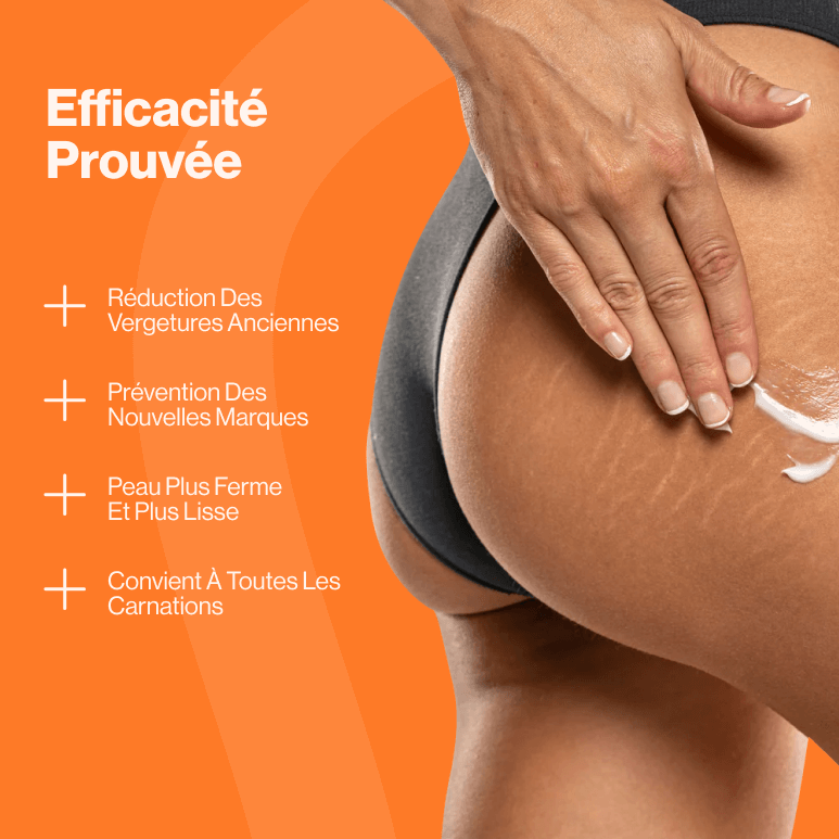 Flexa – La solution anti-vergetures